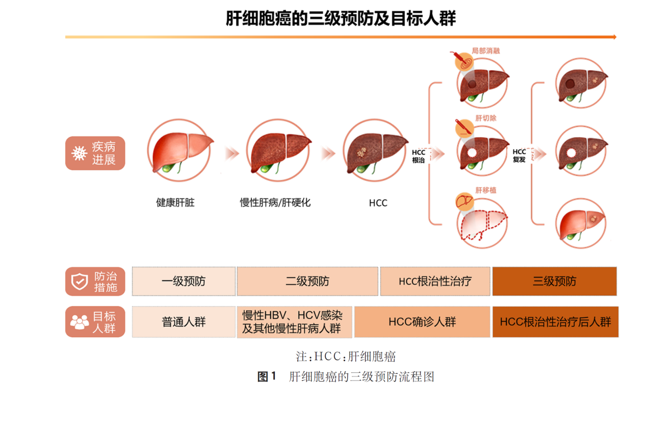 原發(fā)性肝癌三級預防共識（2022年版）指出復方鱉甲軟肝片有助于降低肝癌復發(fā)風險